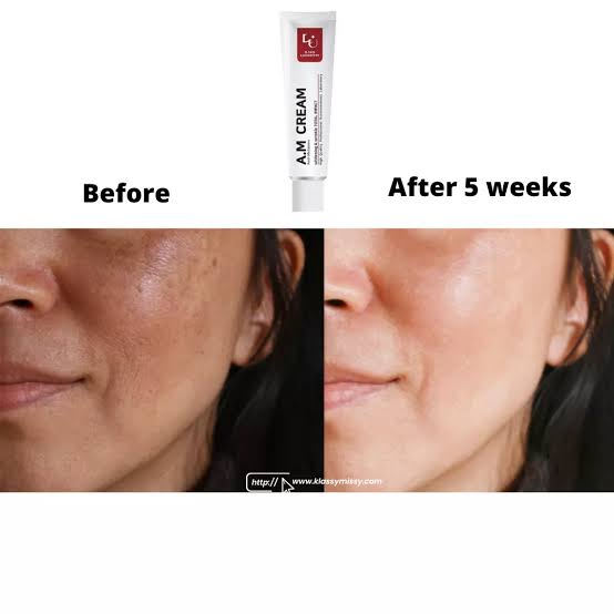 W.SKIN LABORATORY A.M Cream (Anti-Melasma)